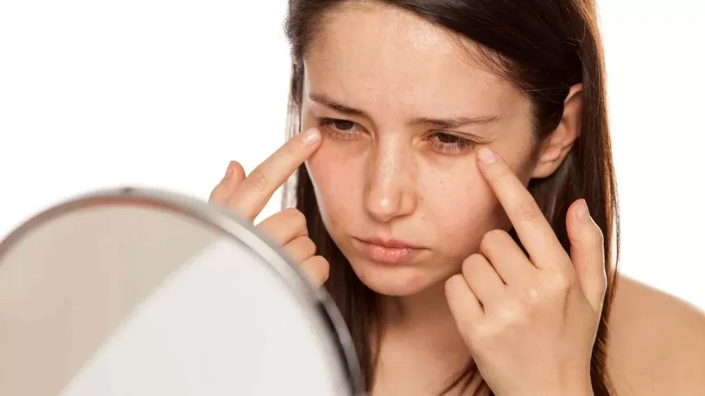Understanding and Managing Dark Eye Circles