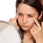 Understanding and Managing Dark Eye Circles